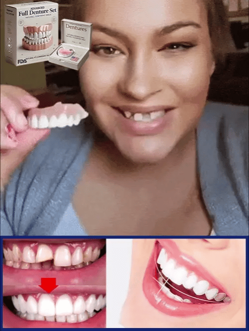 🦷Advanced Customized Full Denture Set🦷  (🔥10.000+ Sold In Last 30 Day)
